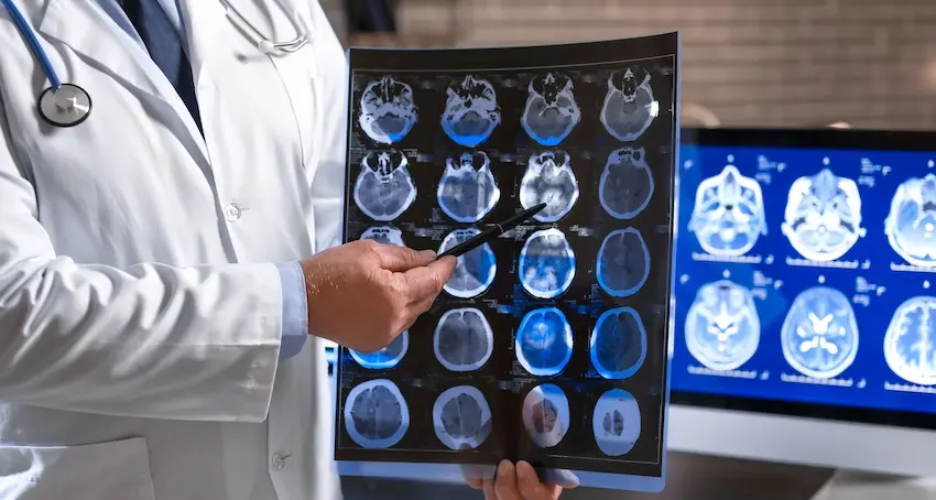 A doctor is examining CT scan images which are showing a brain injury diagnosis and neurological damage assessment in South Carolina.