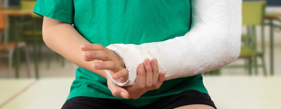 A man has a broken arm and could use help from a personal injury lawyer.